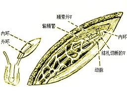 检查精索静脉曲张