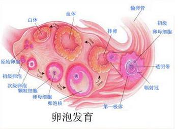 多囊卵巢综合症的原因是什么