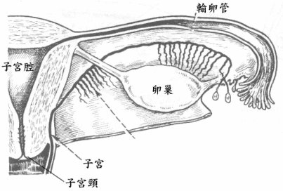 子宫内膜异位症