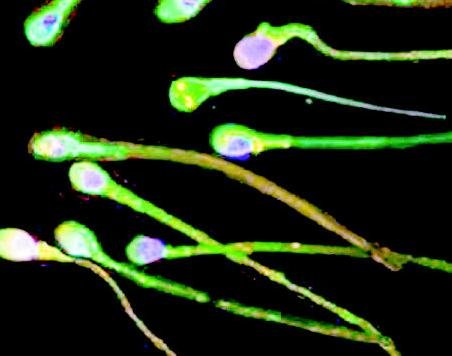 什么因素会导致男性逆行射精