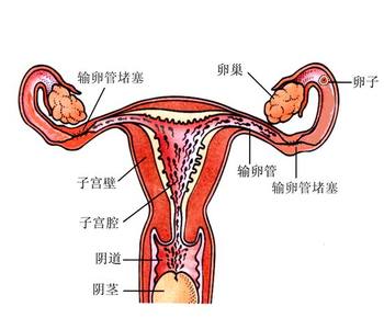 治疗输卵管堵塞哪里好