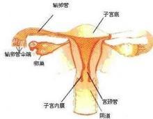 输卵管堵塞