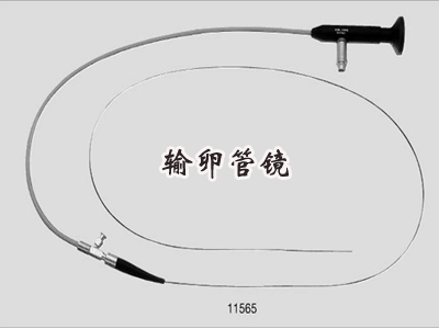 输卵管镜