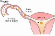 子宫内膜厚度