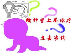 由于输卵管的伞端是游离的,所以输卵管上举是相对而言的,也就是说这次